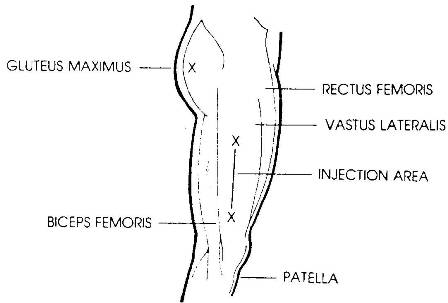 Location for thigh injection