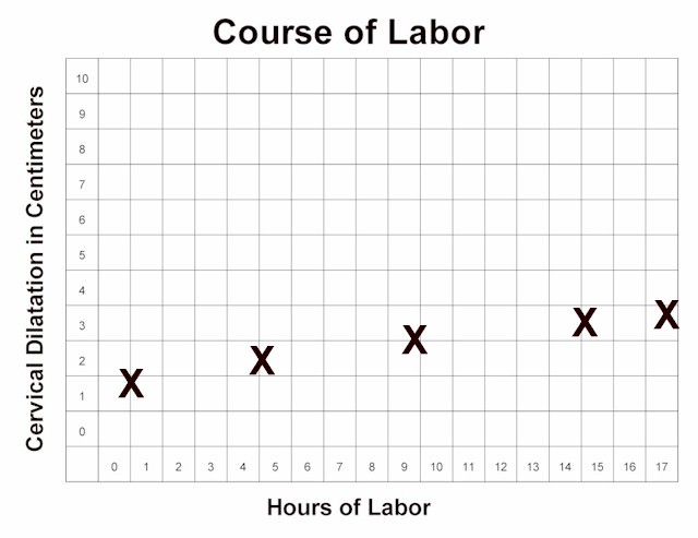 Latent Stage