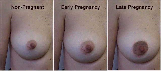 Breast changes over the course of pregnancy