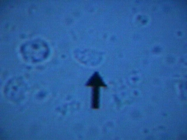 Trichomonas can be seen Moving Under NaCl