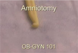 Amniotomy Video