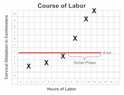 Active phase of labor