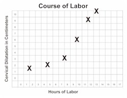 Normal labor curve