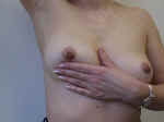 Feel for breast lumps