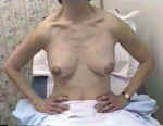 arms flexed during breast inspection