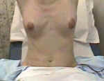 Arms up during breast inspection