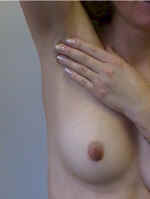 The same circular motion should be used to exam the armpit and the "tail" of the breast that extends up into the armpit.