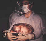 Dr. Hughey removing a 70 pound ovarian cyst