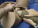 Have your assistant apply suprapubic pressure to keep the fetal head flexed. 
