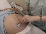 Listen to the fetal heart with a doppler