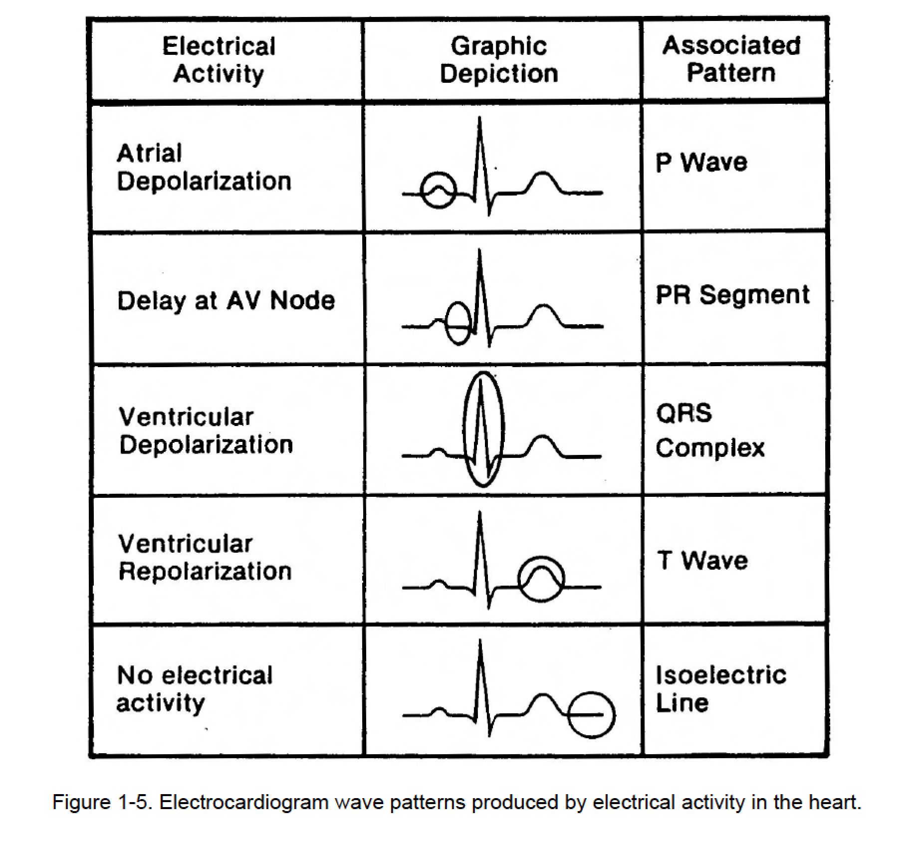 GRAPHIC DISPLAY OF ELECTROCARDIOGRAM C Cardiac Rhythm Interpretation