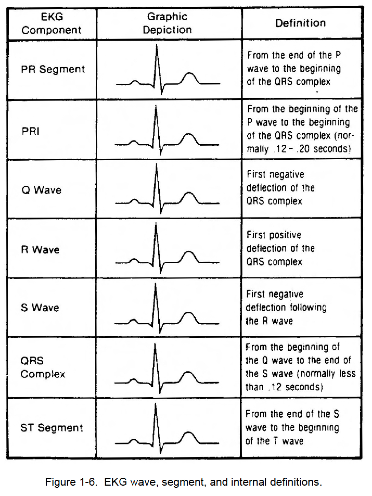 Figure Ekg Wave Segment And Internal Definitions Cardiac