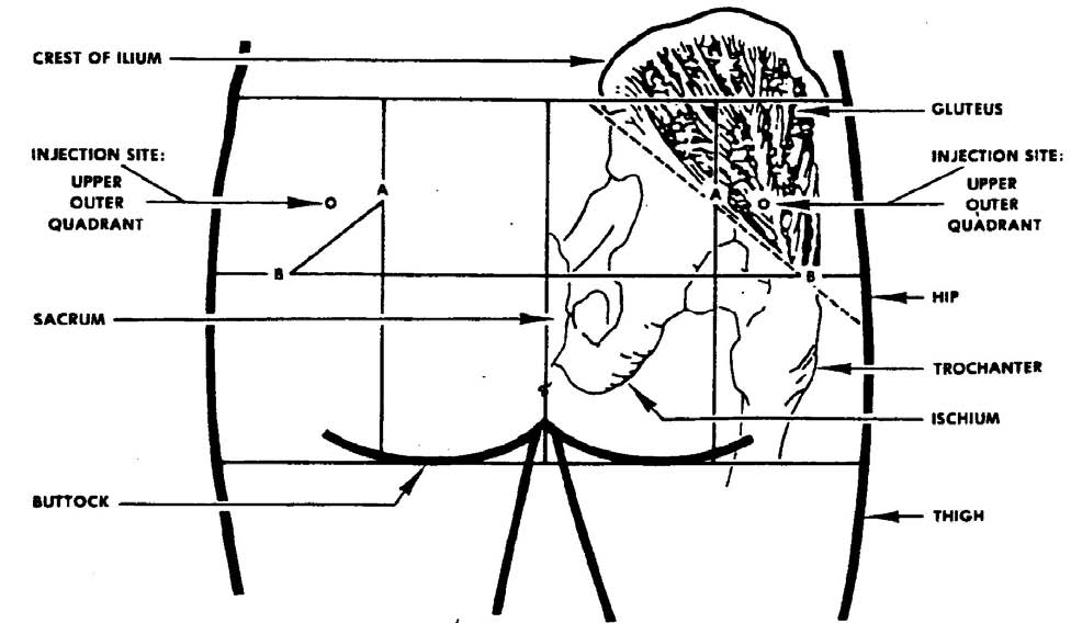 2 03 Procedure For Administering An Intramuscular