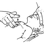 Figure 6-4. Locating the compression site on an infant.