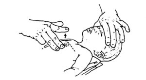 Figure 6-4. Locating the compression site on an infant.