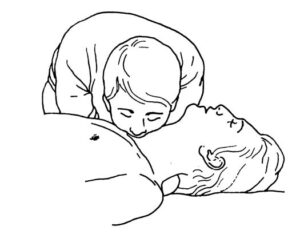 Figure 3-8. Administering mouth-to-stoma rescue breathing.