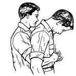 Figure 5-3. Administering an abdominal thrust to a standing casualty.