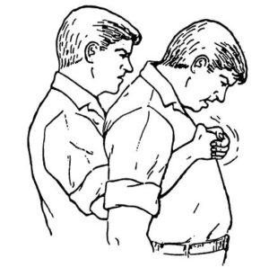 Figure 5-4. Administering a chest thrust to a standing casualty.