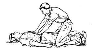 Figure 5-6. Administering a modified abdominal thrust to an unconscious casualty.