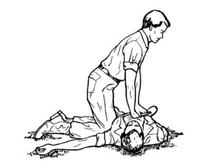Figure 5-7. Administering a modified chest thrust to an unconscious casualty.