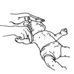 Figure 6-3. Checking an infant for a brachial pulse.