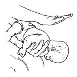 Figure 7-1. Administering backblows to a small infant.