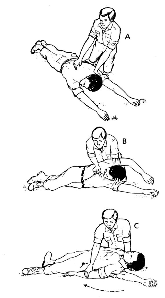 Figure 3-1. Rolling a casualty onto his back.