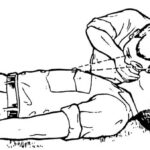 Figure 3-4. Check for breathing using the head-tilt/chin-lift.