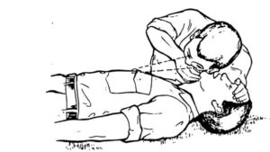 Figure 3-4. Check for breathing using the head-tilt/chin-lift.
