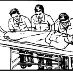 Figure 3-5A. Team member number one positioning patient for three-man carry, bed to wheeled litter.