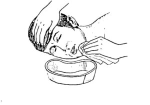 Figure 3-4. Care of patient vomiting.