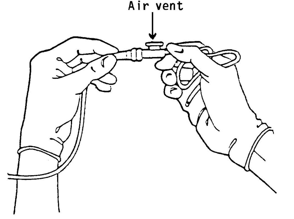 Figure 3-7. The connection of the suction catheter and the tube from the suction machine.