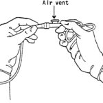 Figure 3-7. The connection of the suction catheter and the tube from the suction machine.