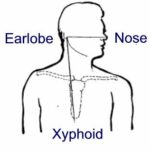Figure 4-3. NEX -- Nose to Ear to Xiphoid.