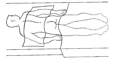Patient in prone position for intramuscular injection in the buttocks. 
