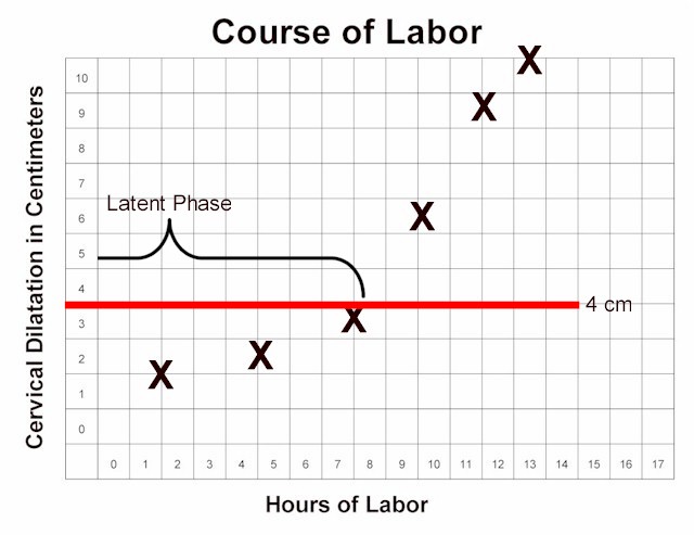 Stations Of Labor Chart