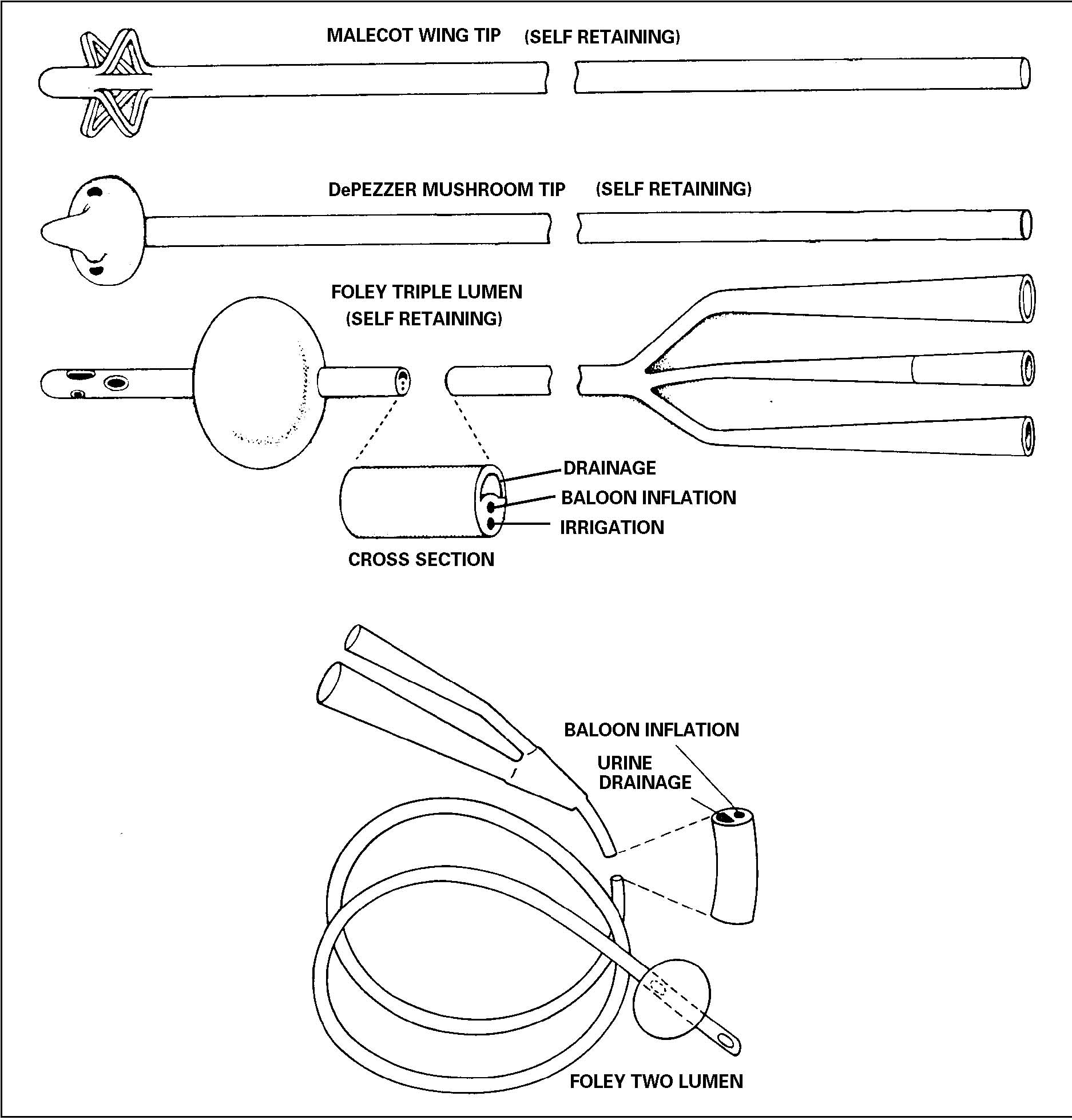 urinary catheter types