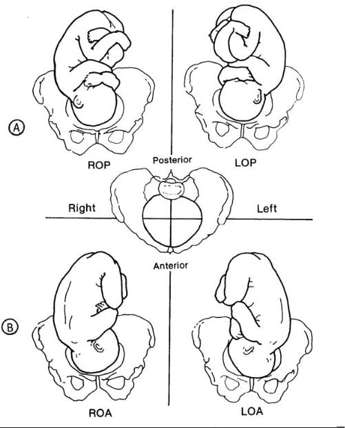 types of fetal presentation vertex