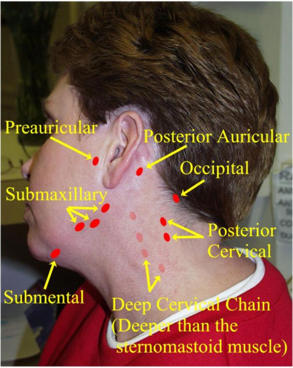 sore lymph node back of neck