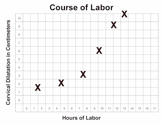 Phases Of Labor Chart