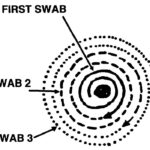 Figure 4-7. Puncture wound.