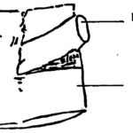 Figure 4-9. Apply a sterile dressing around a drain.