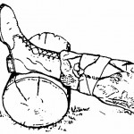 Figure 2-9. Elevating a wound on a leg.