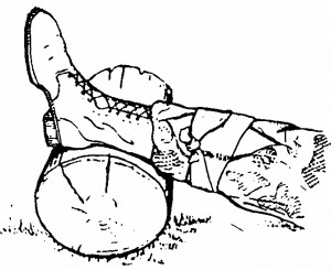 Figure 2-9. Elevating a wound on a leg.