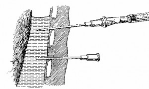 Figure 3-8. Examples of proper needle insertion.
