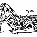 Figure 4-1. Casualty with an open abdominal wound positioned with his knees flexed.