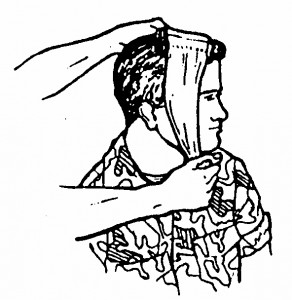 Figure 5-4. Bringing the tail under the chin (wound on top of the head).