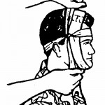Figure 5-6. Tying the tails on the side of the head (wound on top of head).