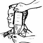 Figure 5-7. Placing the dressing pad over the wound (wound on cheek).