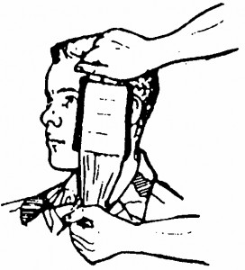 Figure 5-7. Placing the dressing pad over the wound (wound on cheek).